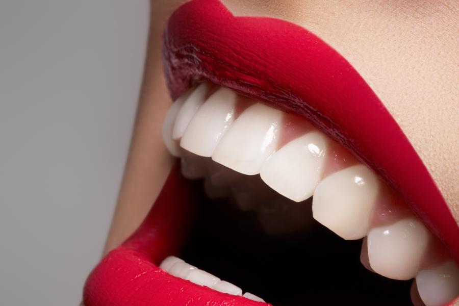 Teeth Whitening Image of Teeth Whitening