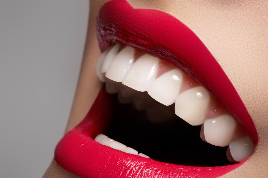 Teeth Whitening Image of Teeth Whitening